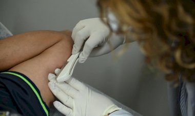 Rede Municipal de Saúde de Barra Mansa oferece Implanon